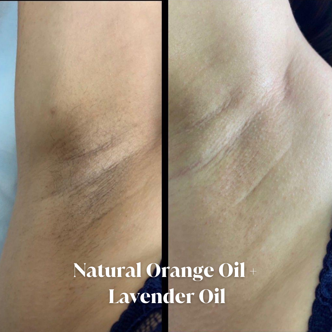 Dark Spots & Pigmentation