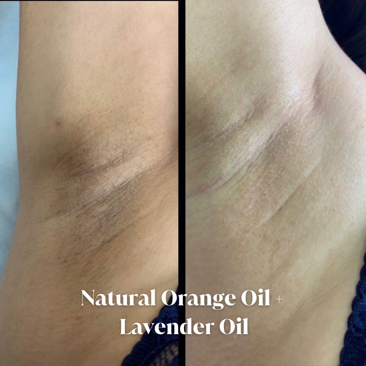 Dark Spots & Pigmentation